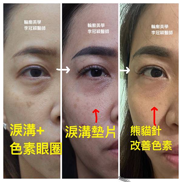 /tmp/phpTEehCE /tmp/phpTEehCE