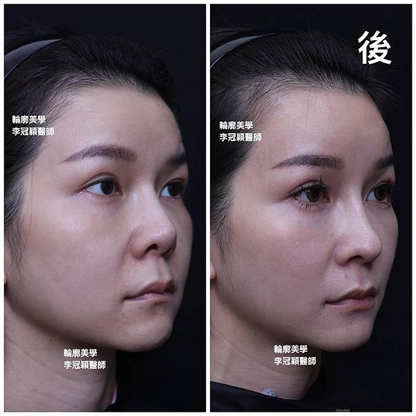 /tmp/phprV9Bki /tmp/phprV9Bki