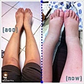 ago&now腿
