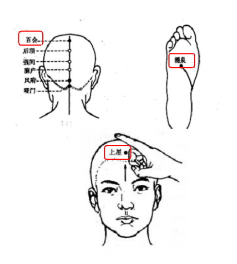 百會穴痛.jpg