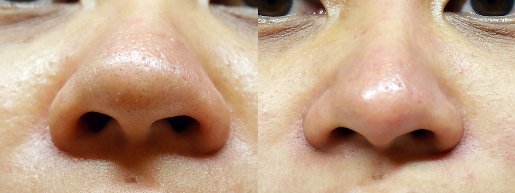 /tmp/phpIhzpAp /tmp/phpIhzpAp