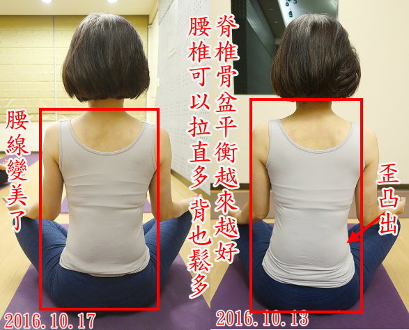 华:脊椎骨盆平衡越来越好 腰椎可以拉直多 背也松多