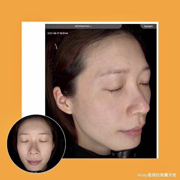 S__101179401 S__101179401