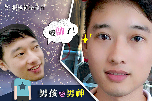 振倫雙眼皮大圖 振倫雙眼皮大圖