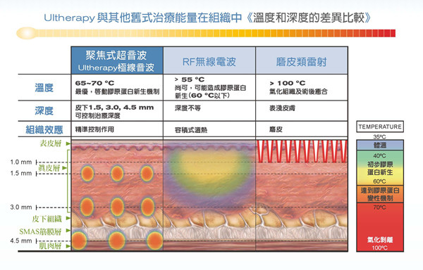 Ultherapy123_ 內頁_副本.jpg