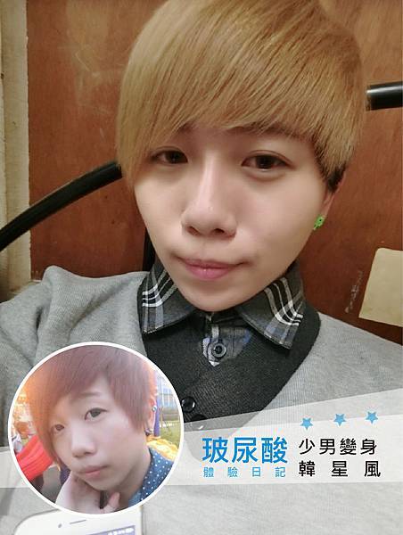 玻尿酸_少男變身韓星風-01-01 玻尿酸_少男變身韓星風-01-01