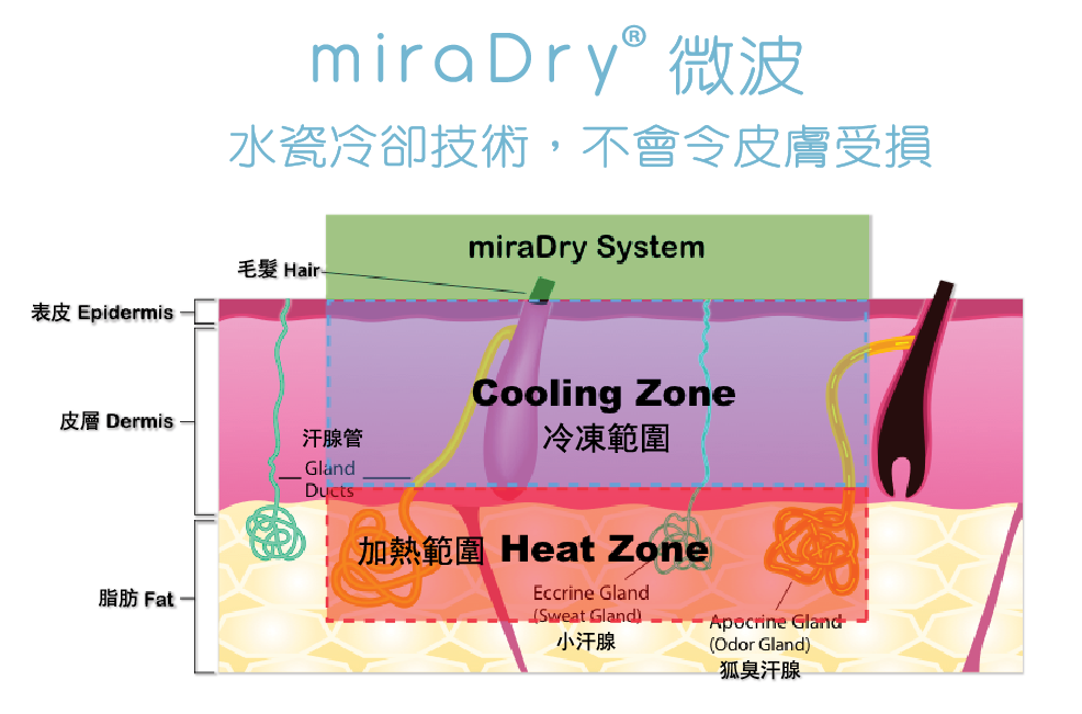 【miraDry微舒净】摆脱腋下烦恼、异味的