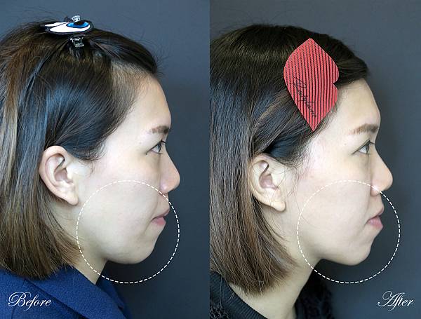 對比3.jpg 對比3.jpg