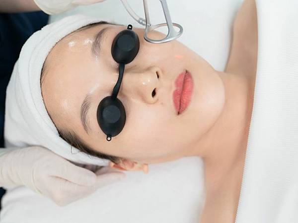 Trị Mụn Bằng Laser Giá Bao Nhi