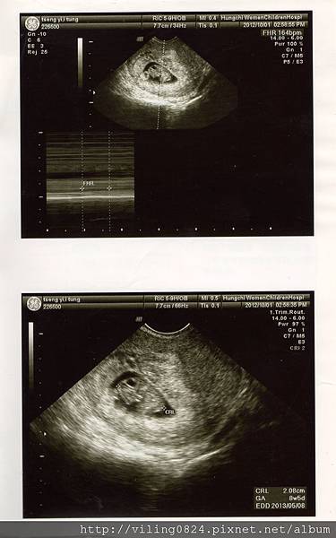 8W5D