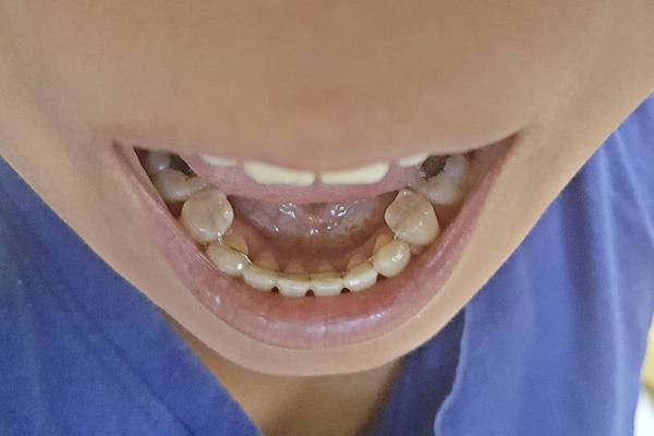 20180617_121028-1.jpg 20180617_121028-1.jpg