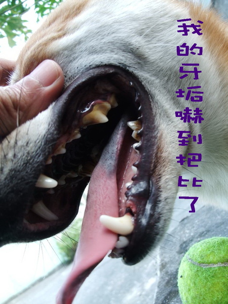 洗牙前牙垢.jpg 洗牙前牙垢.jpg