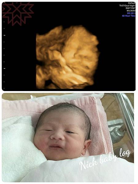 【 孕期點滴 】胎兒超音波界的ＬＶ　禾馨產檢紀錄心得分享