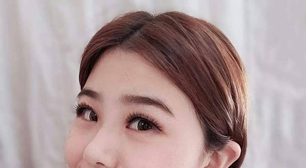 割双眼皮前 (2).jpg