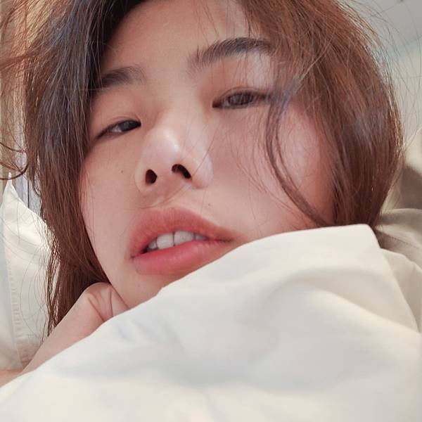 割双眼皮前 (1).jpg