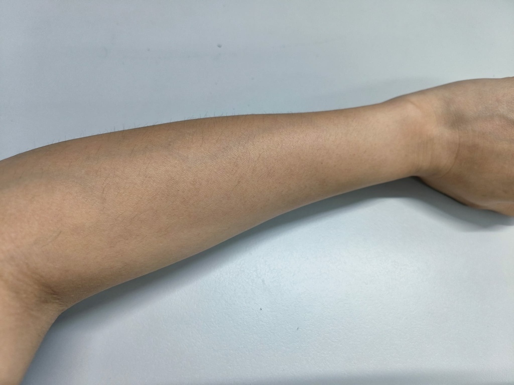 真空除毛推荐 ,悠美诊所-台中分院评价、疗程分享 (15).jpg 真空除毛推荐 ,悠美诊所-台中分院评价、疗程分享 (15).jpg