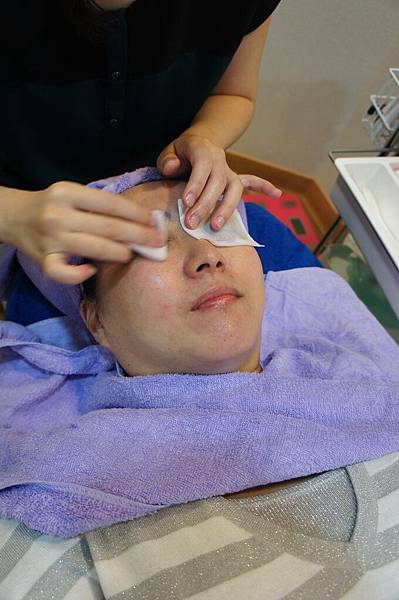 緻美診所脈衝光