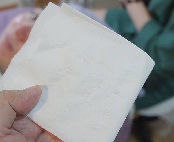 緻美診所杏仁酸煥膚