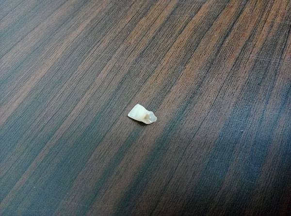 107.02.12大寶米娜掉第一顆牙齒 (4)_調整大小.jpg