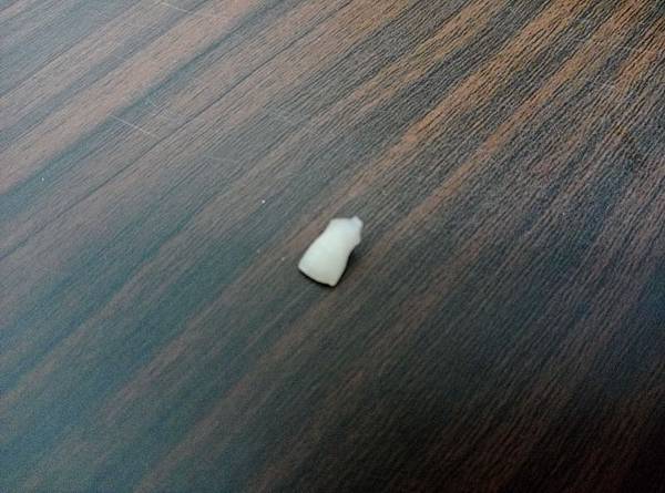 107.02.12大寶米娜掉第一顆牙齒 (5)_調整大小.jpg