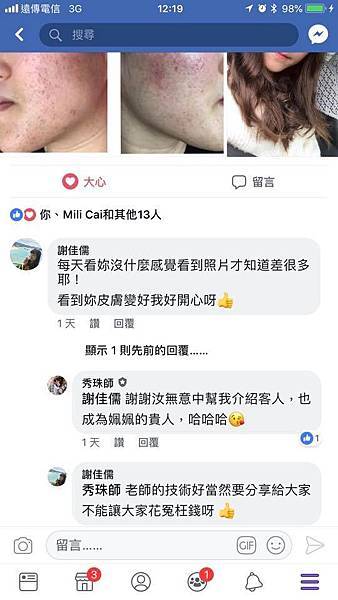 【痘痘粉刺成功之妏妏正妹】輪班的護理師暴長痘痘粉刺