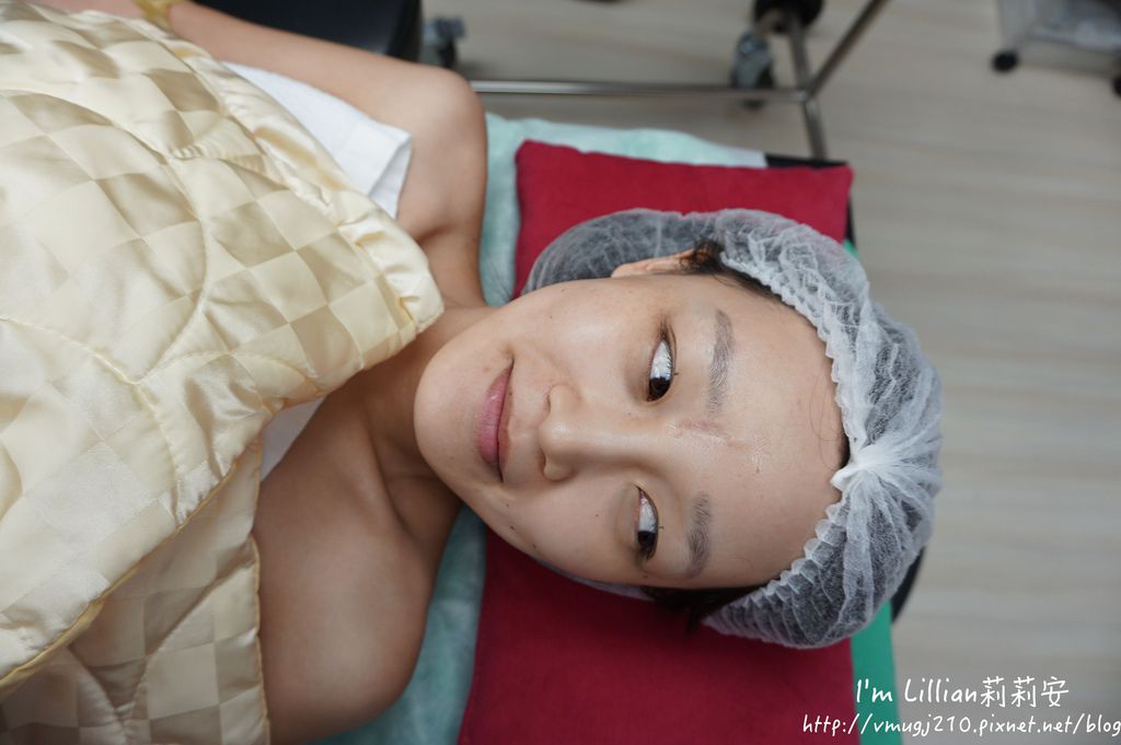 縫訂雙眼皮推薦34台北格雷斯醫美周哲宇醫師.JPG