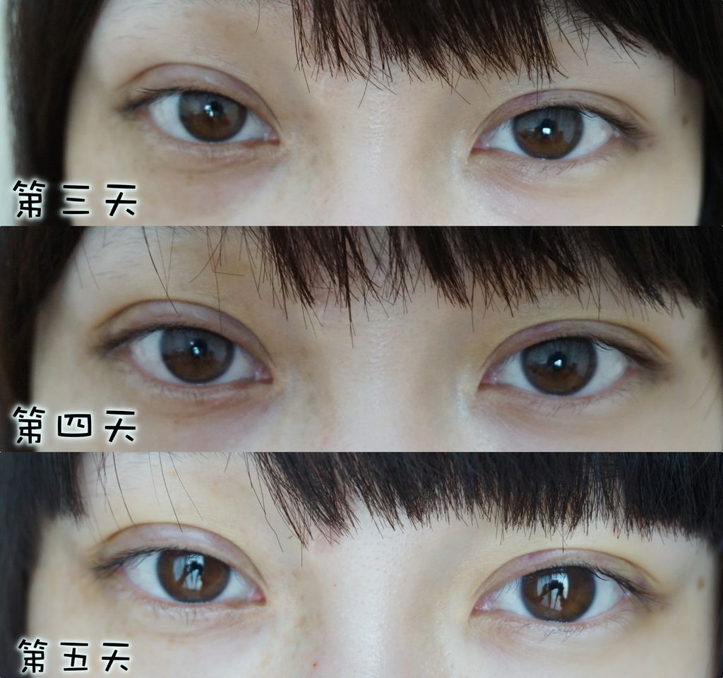 術後2.jpg