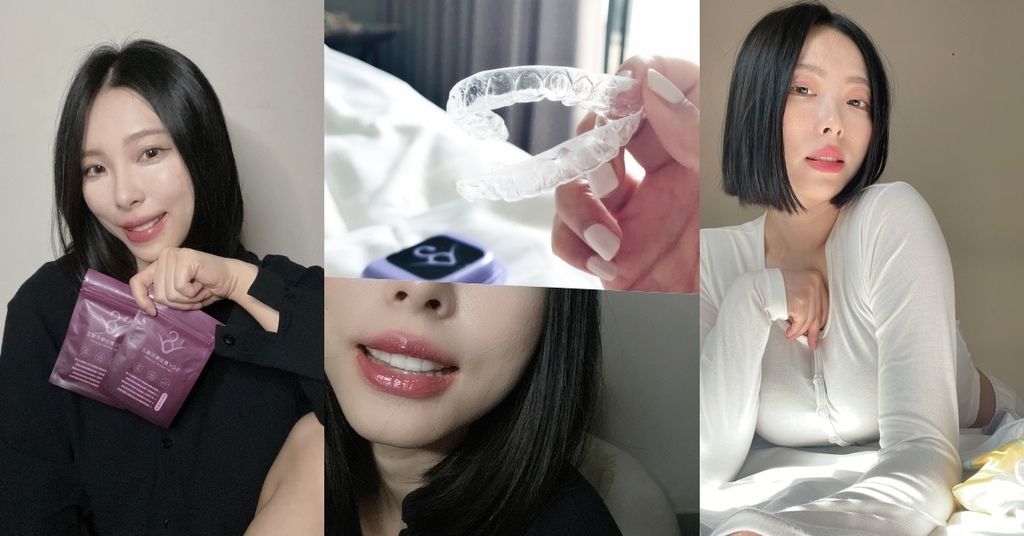牙齒矯正-完成篇！成年女子的隱形牙套「露齒大笑不害羞」SOV