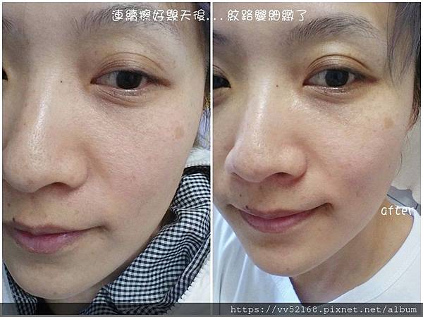 BC百匡,靚顏抗皺淡紋賦活油(百匡賦活膠囊),百匡賦活膠囊,
白龍膽花精萃可亮白撫平細紋與修護受傷肌膚,並高度保濕鎖水,延緩肌膚老化,一顆多種用途,強效版晚安面膜
,百匡賦活膠囊,百匡膠囊
