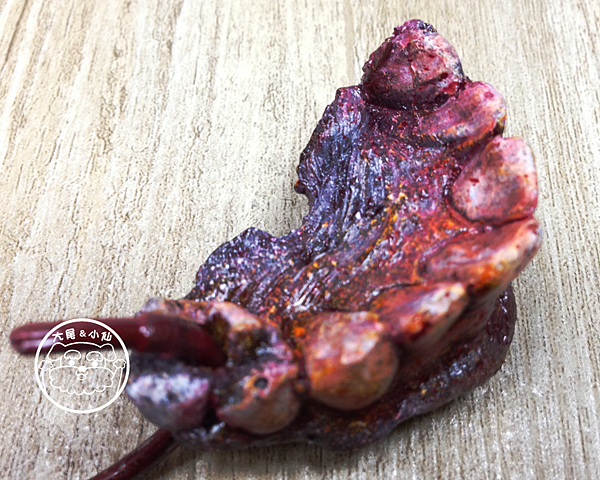 牙齒側面掛勾 牙齒側面掛勾