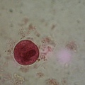 Lab7/Demo的B. coli 大腸纖毛蟲 cyst