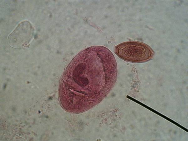 Lab7/Demo的B. coli 大腸纖毛蟲 trophozoite