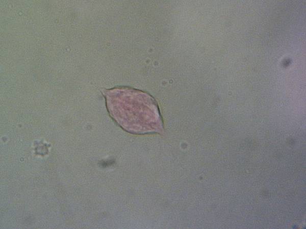Lab7/S41 T.vaginalis的trophozoite