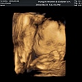 胎兒4D照片.jpg