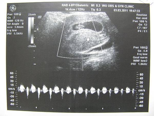 2011.03.03 第三次產檢w7d5 有心跳囉_02.JPG