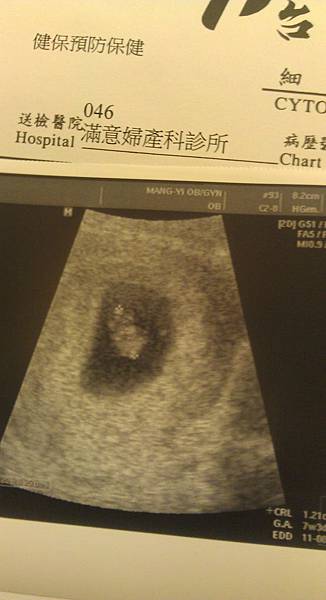 第一次產檢6周