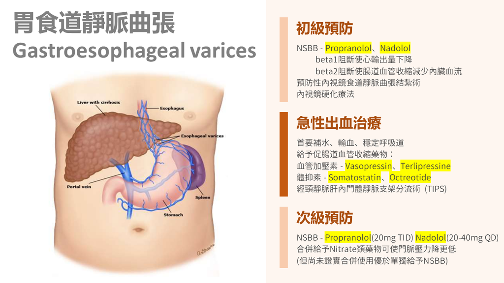 胃食道靜脈瘤出血.png