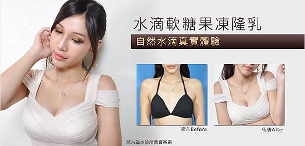 水滴軟糖果凍隆乳 常見問答大解析打造洶湧的美胸心機 渾然天成整形醫美 痞客邦