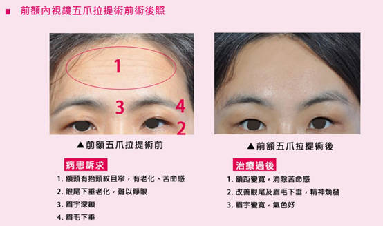 讓母親節變成 好姊妹節 俏媽養成術大公開 渾然天成整形醫美 痞客邦 讓母親節變成 好姊妹節 俏媽養成術大公開 渾然天成整形醫美 痞客邦
