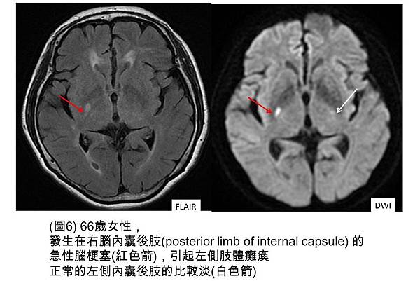 投影片6