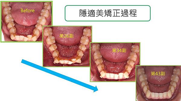 投影片4.JPG