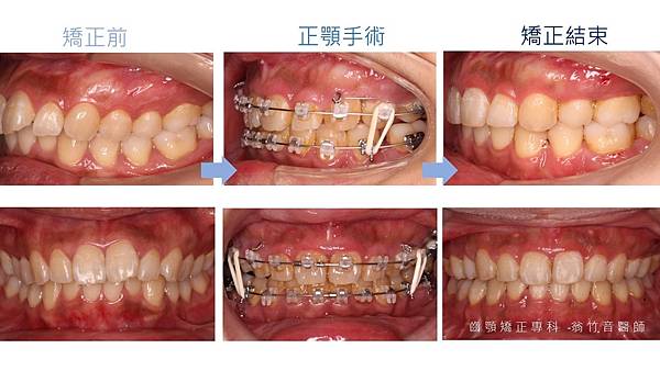 投影片7.JPG