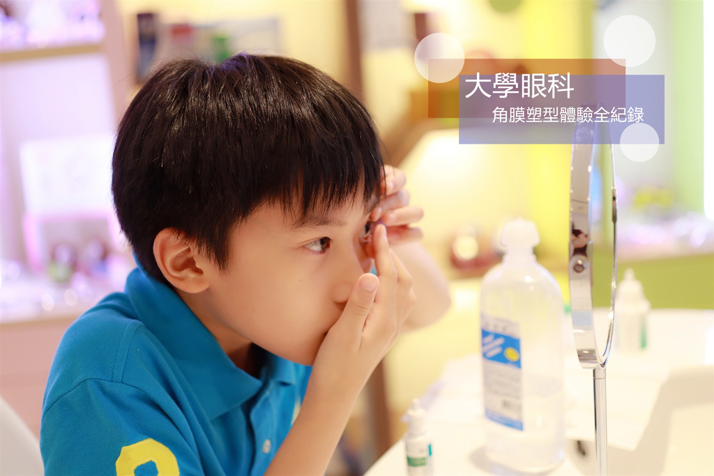 大學眼科角膜塑型片.jpg 大學眼科角膜塑型片.jpg