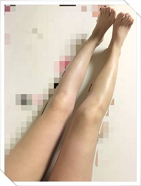 桃園醫美診所推薦 桃園醫美診所推薦