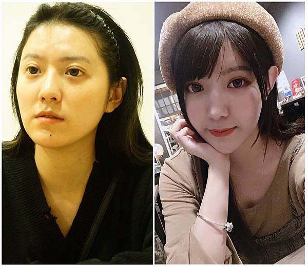 苗栗醫美診所推薦 苗栗整形外科推薦 醫美推薦 整形外科 痞客邦