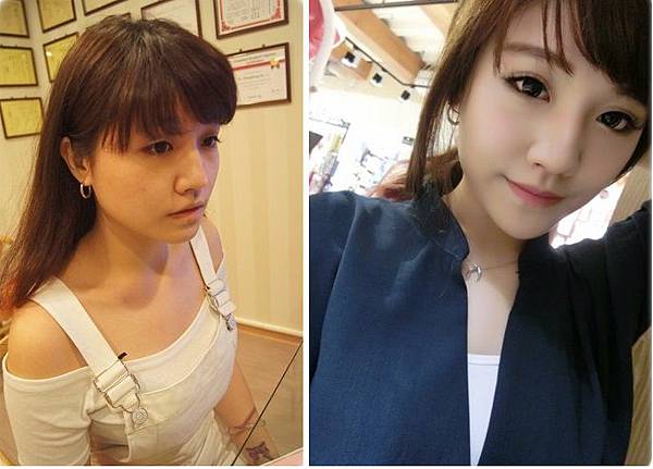 雲林醫美音波拉皮推薦 雲林醫美音波拉皮推薦