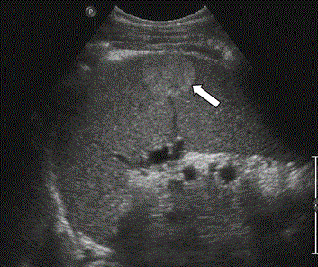 978-3-642-13327-5_131_Fig1_HTML.gif
