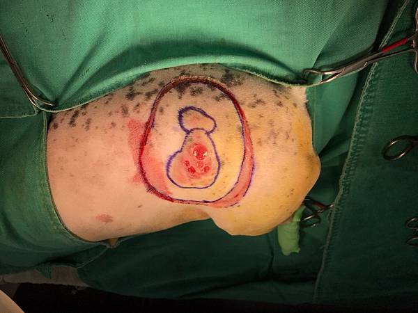 TCXR4108.JPG TCXR4108.JPG