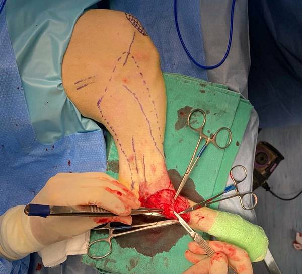 237294743_218645960200089_8987206648865984346_n.jpg 237294743_218645960200089_8987206648865984346_n.jpg