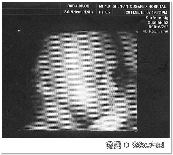 baby-26w5d.jpg